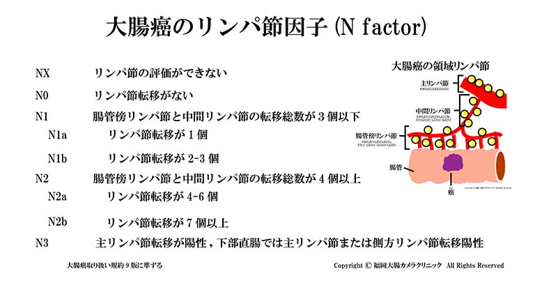 大腸癌のリンパ節因子