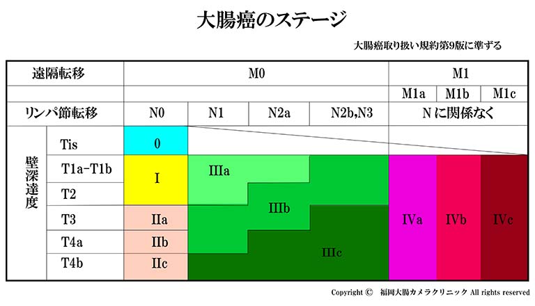 大腸癌のステージ