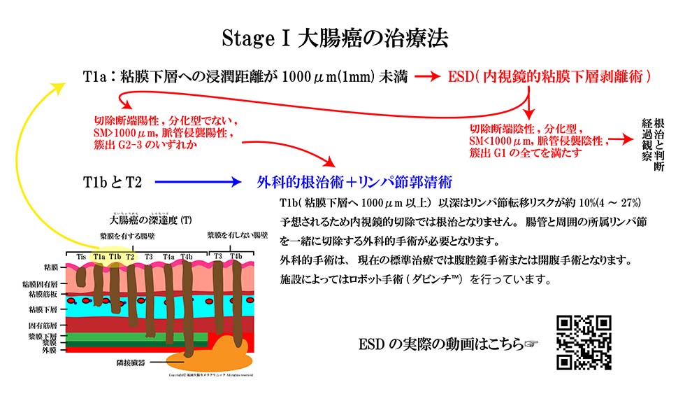 大腸癌の治療法01