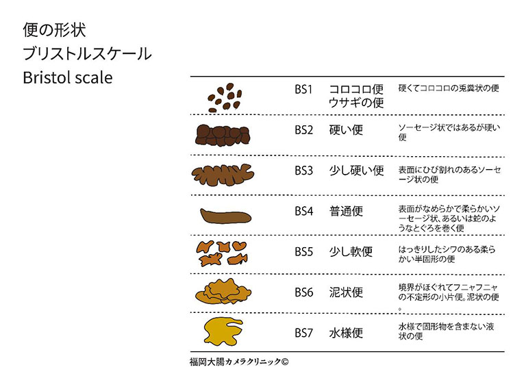 便形状ブリストルスケール、Bristol Scale:BS