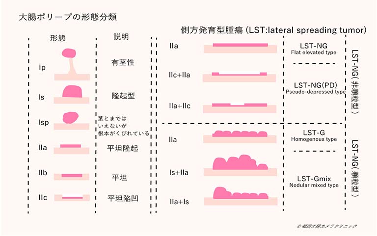 形態分類