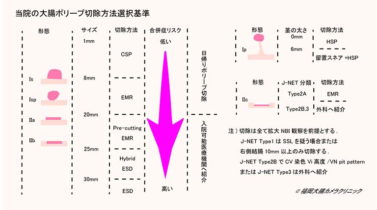 ポリープ切除