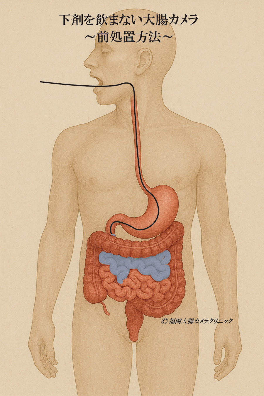 下剤を飲まない大腸カメラ