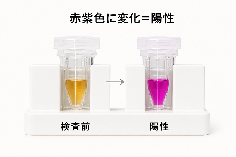 胃カメラ時の生検