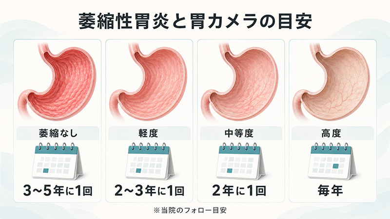 萎縮性胃炎と胃カメラの目安